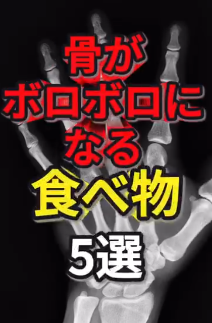 骨がボロボロになる食べ物5選